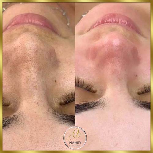 گالری پاکسازی پوست